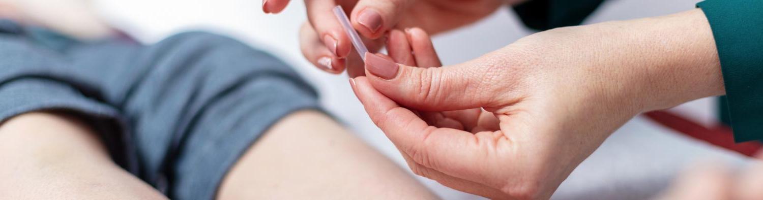 student getting acupuncture